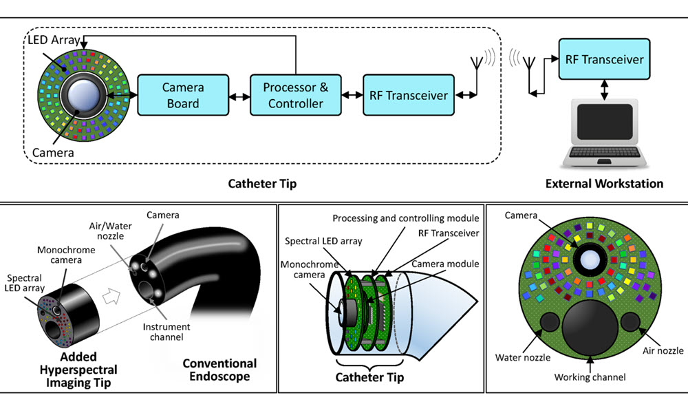 [News] New LED-Based Imaging System Could Transform Cancer Detection in Endoscopy
