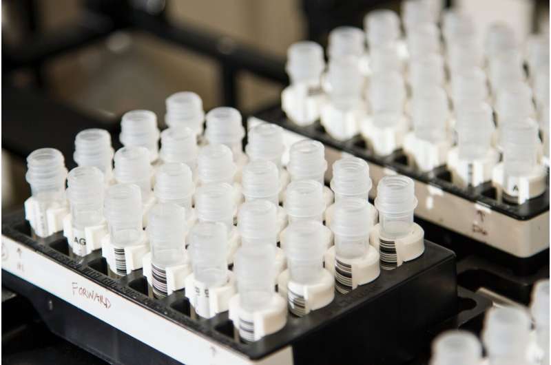 Evaluating the effect of liquid-handling speed on yeast growth using robots