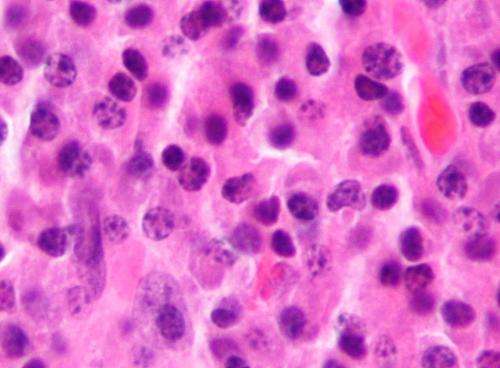 Ireland’s first BioBrillouin microscope will enable non-invasive assessment of living cells and tissues in real-time