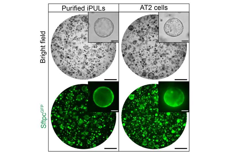 Lung cells generated from mouse fibroblasts in just 7 to 10 days without stem cell tech