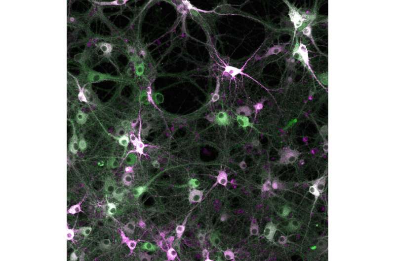 Scientists develop novel recording tool to monitor protein kinase activities in living cells