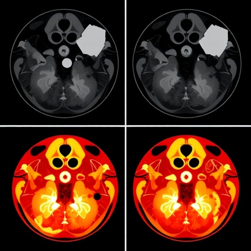 AI Predicts Sinus Surgery Outcomes from Images