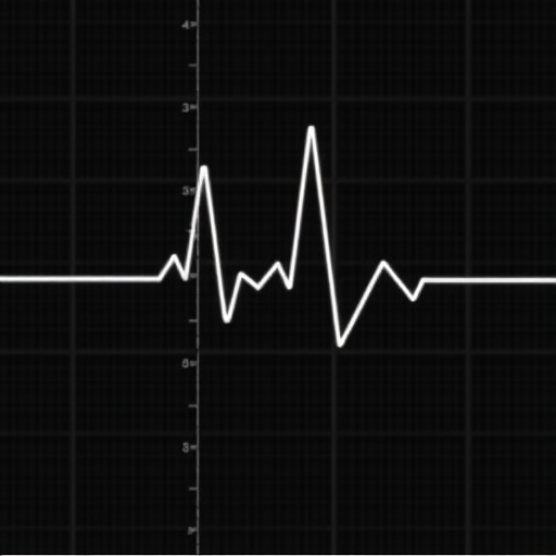 Hybrid Approach Detects Ballistocardiogram Motion Artifacts